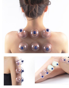 cupping%20vacuum%20massage%20211